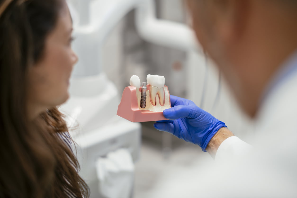 dental implants in leicester