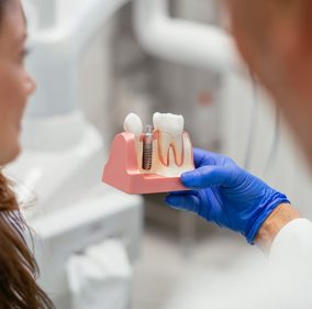 Why Care for Dental Implants is Essential
