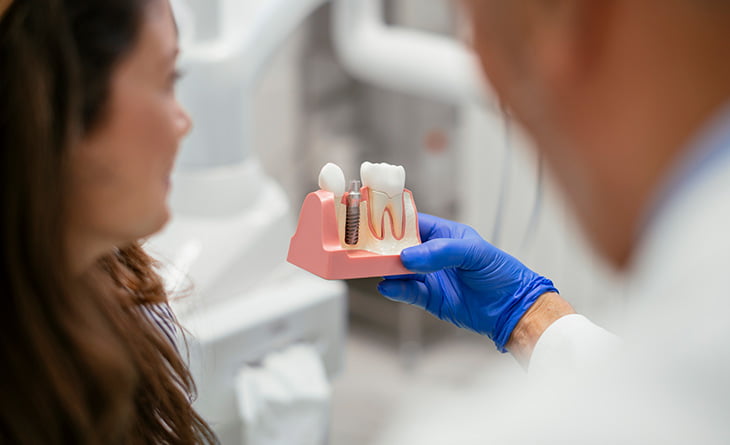 Why Care for Dental Implants is Essential